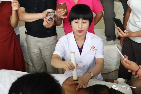 探索艾灸奥秘，开启健康之旅—悬灸艾灸培训班
